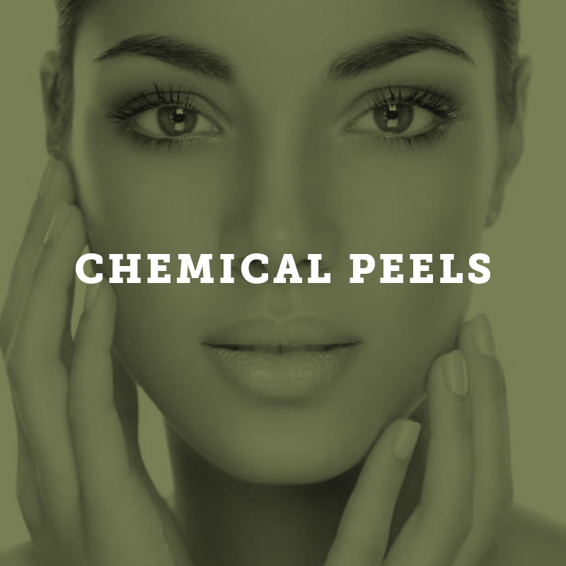 peels Services