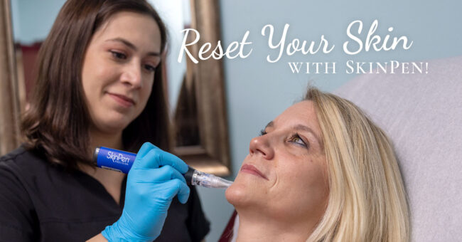 Skin Center at Southgate_Skin Pen Reset your skin with SkinPen! Image: A Skin Center professional applies a SkinPen to a satisfied patient.