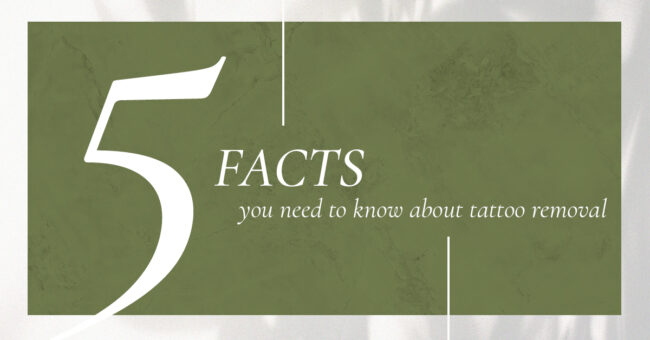 5_Facts_About_Tattoo_Removal