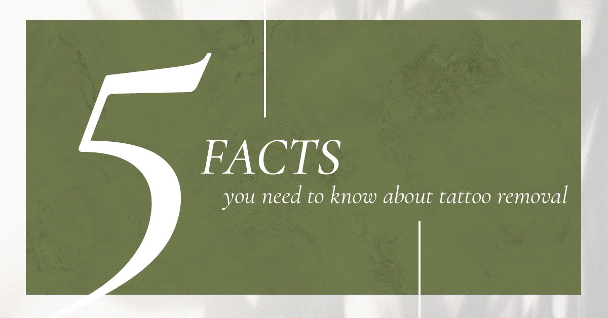5_Facts_About_Tattoo_Removal