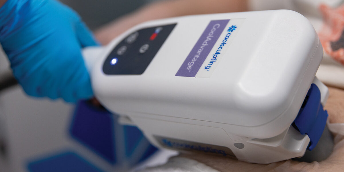 SOUTHGATE_COOLSCULPTING_1200x630