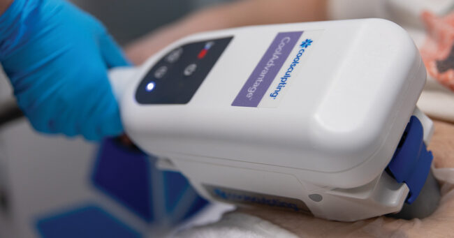 SOUTHGATE_COOLSCULPTING_1200x630