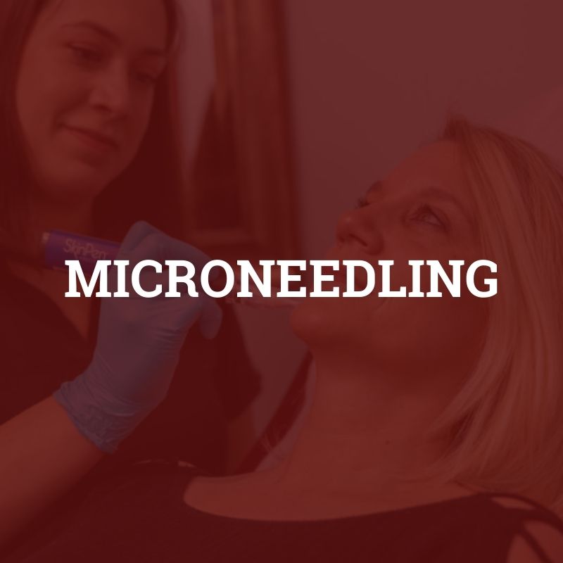 microneedling services microneedling services
